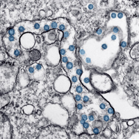 The COVID-19 Crisis Response: putting women at the centre