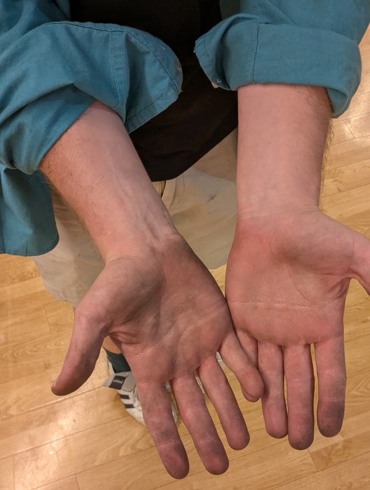 Researcher’s open hands stained on palms and fingertips with archival residue after handling historic documents during hands-on archival research.