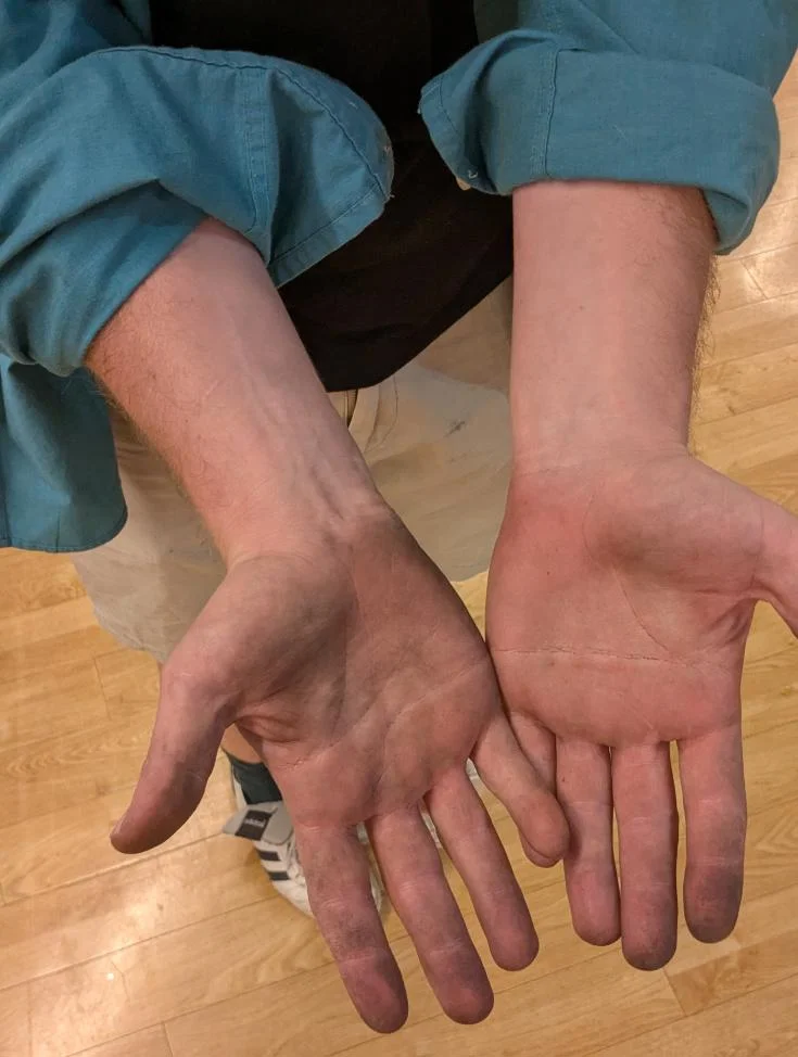 Researcher’s open hands stained on palms and fingertips with archival residue after handling historic documents during hands-on archival research.