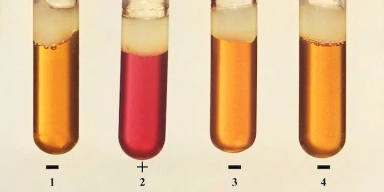 Liquid samples in vials