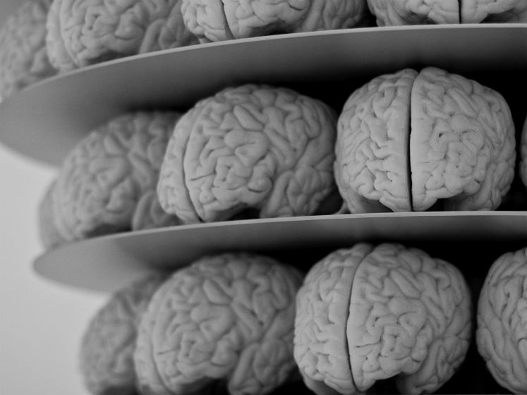 Brains 747x560