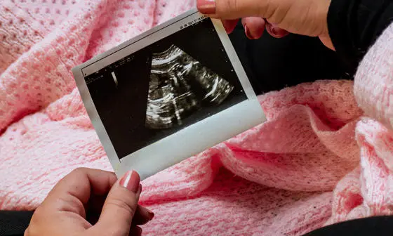 baby scan