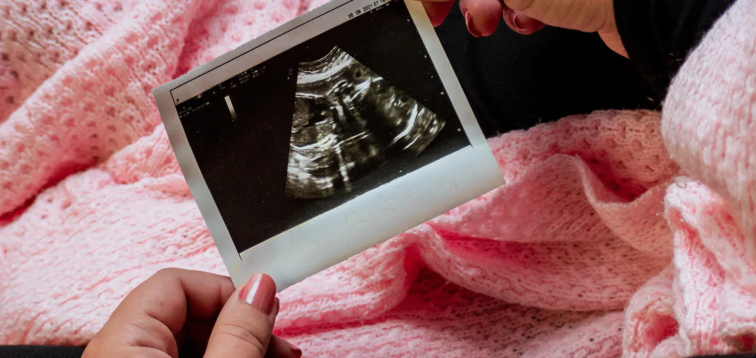 baby scan