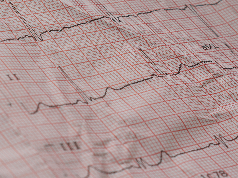 Heart rate graph