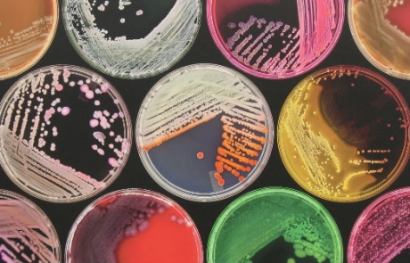 The evolution of cultures, human and microbial